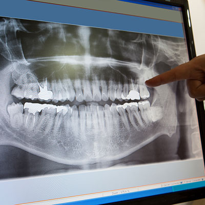 Dentist looking at x-rays